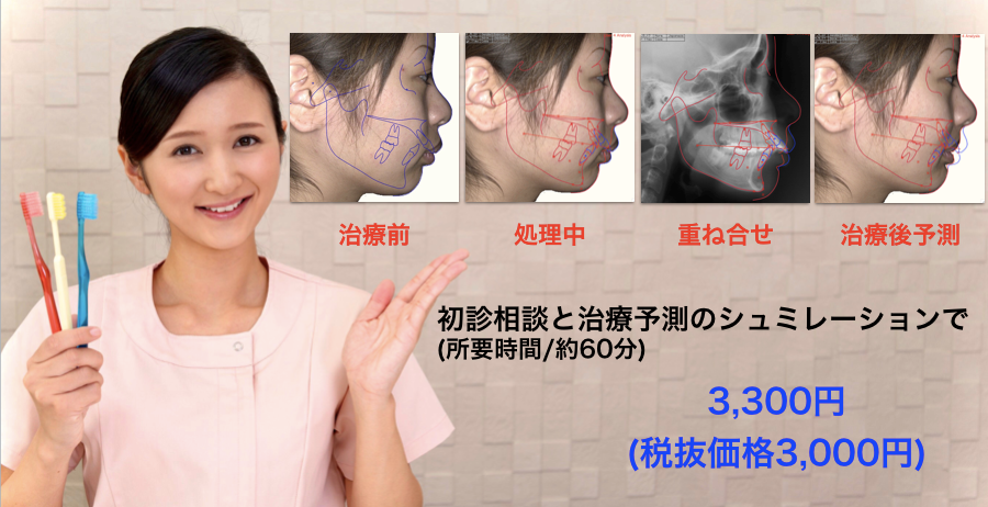 ビフォーアフター