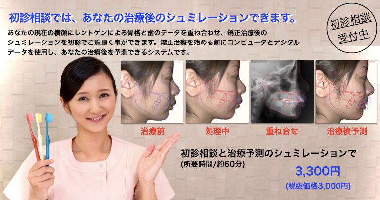 ビフォーアフター